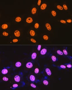 Invitrogen SFPQ Recombinant Rabbit Monoclonal Antibody (8Y5S6) 100 &mu;L;