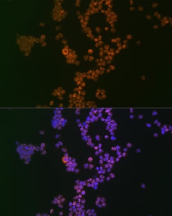 Invitrogen IKAROS Recombinant Rabbit Monoclonal Antibody (4S10I3) 100 &mu;L;