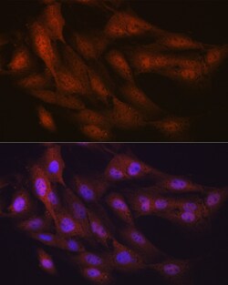 Invitrogen Ub-K48 Recombinant Rabbit Monoclonal Antibody (5Y8J0) 100 &mu;L;