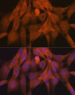 Invitrogen Ub-K48 Recombinant Rabbit Monoclonal Antibody (5Y8J0) 100 &mu;L;