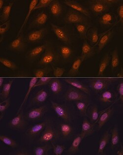 Invitrogen Ub-K48 Recombinant Rabbit Monoclonal Antibody (5Y8J0) 100 &mu;L;