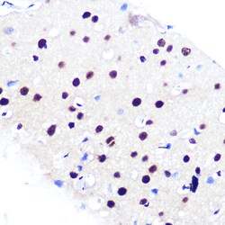 Invitrogen RbAp48 Recombinant Rabbit Monoclonal Antibody (0D1X1) 100 μL;