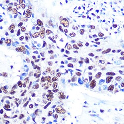 Invitrogen RbAp48 Recombinant Rabbit Monoclonal Antibody (0D1X1) 100 μL;