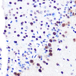 Invitrogen RbAp48 Recombinant Rabbit Monoclonal Antibody (0D1X1) 100 μL;