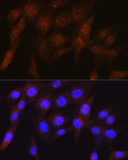 Invitrogen PSMD4 Recombinant Rabbit Monoclonal Antibody (5G1X6) 100 &mu;L;