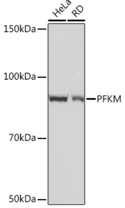 Invitrogen PFKM Recombinant Rabbit Monoclonal Antibody (4Z7X1) 100 &mu;L;