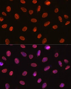 Invitrogen SNRPA Recombinant Rabbit Monoclonal Antibody (8I3P5) 100 &mu;L | Buy Online | Invitrogen&trade; | Fisher Scientific