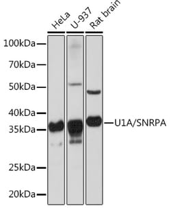 Invitrogen SNRPA Recombinant Rabbit Monoclonal Antibody (8I3P5) 100 &mu;L | Buy Online | Invitrogen&trade; | Fisher Scientific