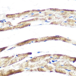 Invitrogen FBXO32 Recombinant Rabbit Monoclonal Antibody (1F10Z5) 100 &mu;L;