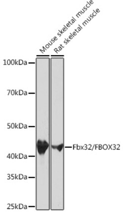 Invitrogen FBXO32 Recombinant Rabbit Monoclonal Antibody (1F10Z5) 100 &mu;L;