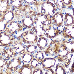 Invitrogen NCF2 Recombinant Rabbit Monoclonal Antibody (7J7N3) 100 &mu;L;