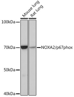 Invitrogen NCF2 Recombinant Rabbit Monoclonal Antibody (7J7N3) 100 &mu;L;