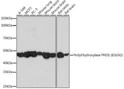Invitrogen PHD1 Recombinant Rabbit Monoclonal Antibody (2G9M7) 100 &mu;L;