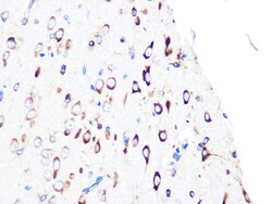 Invitrogen PUMA alpha Recombinant Rabbit Monoclonal Antibody (9C5W5) 100