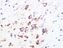 Invitrogen PUMA alpha Recombinant Rabbit Monoclonal Antibody (9C5W5) 100