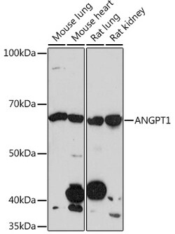 Invitrogen Angiopoietin 1 Recombinant Rabbit Monoclonal Antibody (6C4S7) 100 &mu;L | Buy Online | Invitrogen&trade; | Fisher Scientific