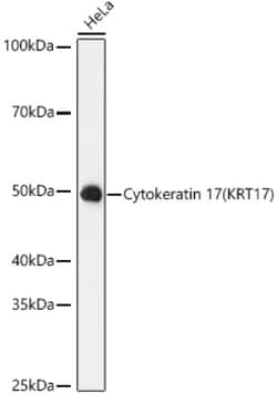 Invitrogen Cytokeratin 17 Recombinant Rabbit Monoclonal Antibody (9O6X9)