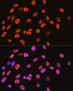 Invitrogen NONO Recombinant Rabbit Monoclonal Antibody (0V0N8) 100 &mu;L;