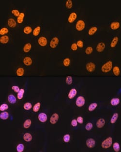 Invitrogen NONO Recombinant Rabbit Monoclonal Antibody (0V0N8) 100 &mu;L;