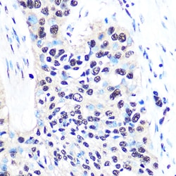 Invitrogen NONO Recombinant Rabbit Monoclonal Antibody (0V0N8) 100 &mu;L;