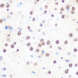 Invitrogen NONO Recombinant Rabbit Monoclonal Antibody (0V0N8) 100 &mu;L;
