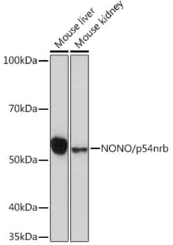 Invitrogen NONO Recombinant Rabbit Monoclonal Antibody (0V0N8) 100 &mu;L;