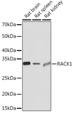 Invitrogen RACK1 Recombinant Rabbit Monoclonal Antibody (7B6J4) 100 &mu;L;
