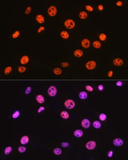 Invitrogen BAF57 Recombinant Rabbit Monoclonal Antibody (9L5F6) 100 &mu;L;