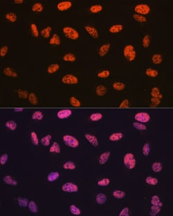 Invitrogen BAF57 Recombinant Rabbit Monoclonal Antibody (9L5F6) 100 &mu;L;