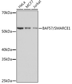 Invitrogen BAF57 Recombinant Rabbit Monoclonal Antibody (9L5F6) 100 &mu;L;