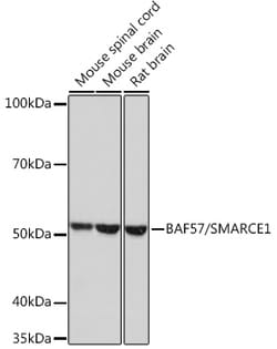 Invitrogen BAF57 Recombinant Rabbit Monoclonal Antibody (9L5F6) 100 &mu;L;