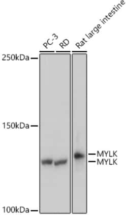 Invitrogen MYLK Recombinant Rabbit Monoclonal Antibody (1J2U2) 100 &mu;L | Buy Online | Invitrogen&trade; | Fisher Scientific
