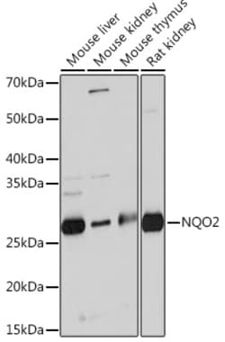 Invitrogen NQO2 Recombinant Rabbit Monoclonal Antibody (5E0B2) 100 &mu;L | Buy Online | Invitrogen&trade; | Fisher Scientific