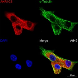 Invitrogen AKR1C3 Recombinant Rabbit Monoclonal Antibody (7T10F5) 100 &mu;L;
