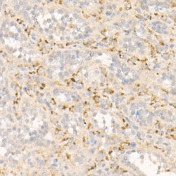 Invitrogen FGF21 Recombinant Rabbit Monoclonal Antibody (5K8E4) 100 &mu;L;