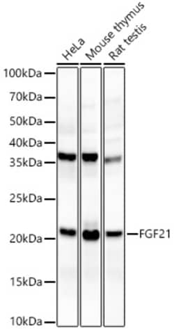 Invitrogen FGF21 Recombinant Rabbit Monoclonal Antibody (5K8E4) 100 &mu;L;