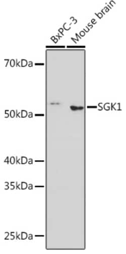 Invitrogen SGK1 Recombinant Rabbit Monoclonal Antibody (3P4N3) 100 &mu;L;