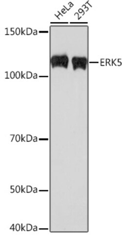 Invitrogen ERK5 Recombinant Rabbit Monoclonal Antibody (5C1P5) 100 &mu;L | Buy Online | Invitrogen&trade; | Fisher Scientific