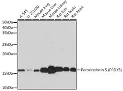 Invitrogen PRDX5 Recombinant Rabbit Monoclonal Antibody (5E10D3) 100 &mu;L;