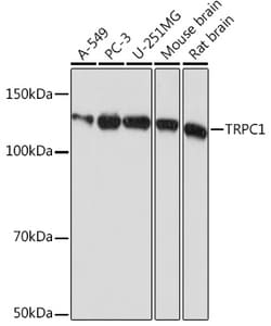 Invitrogen TRPC1 Recombinant Rabbit Monoclonal Antibody (1V3Q2) 100 &mu;L;