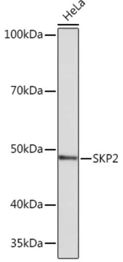 Invitrogen SKP2 Recombinant Rabbit Monoclonal Antibody (2L0K1) 100 &mu;L;