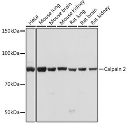 Invitrogen Calpain 2 Recombinant Rabbit Monoclonal Antibody (9Y7I1) 100