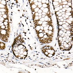 SRSF1 Recombinant Rabbit Monoclonal Antibody (3J5Q9):Antibodies, Recombinant