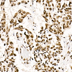 SRSF1 Recombinant Rabbit Monoclonal Antibody (3J5Q9):Antibodies, Recombinant