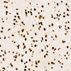 SRSF1 Recombinant Rabbit Monoclonal Antibody (3J5Q9):Antibodies, Recombinant