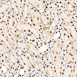 SRSF1 Recombinant Rabbit Monoclonal Antibody (3J5Q9):Antibodies, Recombinant