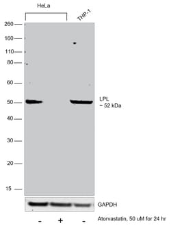 Invitrogen LPL Recombinant Rabbit Monoclonal Antibody (10E10P9) 100 &mu;L;