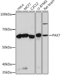 PAX7 Recombinant Rabbit Monoclonal Antibody (5G2Q9) 100 &mu;L | Buy Online | Invitrogen | Fisher Scientific