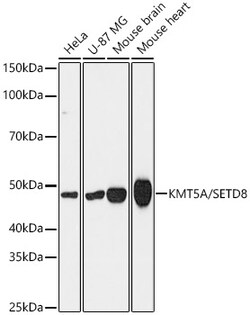 Invitrogen SETD8 Recombinant Rabbit Monoclonal Antibody (5M9P5) 100 &mu;L | Buy Online | Invitrogen&trade; | Fisher Scientific