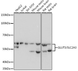 GLUT3 Recombinant Rabbit Monoclonal Antibody (6T3F2):Antibodies, Recombinant